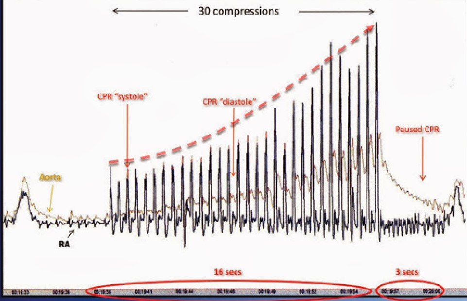 Increase chest compression fraction or reduce CPR pauses. How?